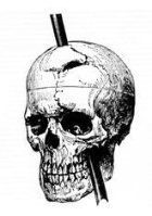 phineas_gage_small