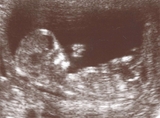 ultrasound_100216_cropped.jpg